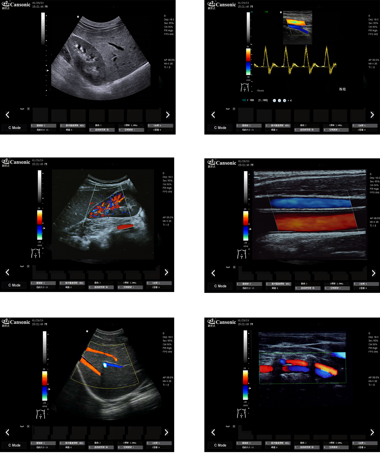 1700723405672.png c923f1d5274cc95842223682c03ca197_58058758-e7ad-4e64-be60-21ed312b9f45.png